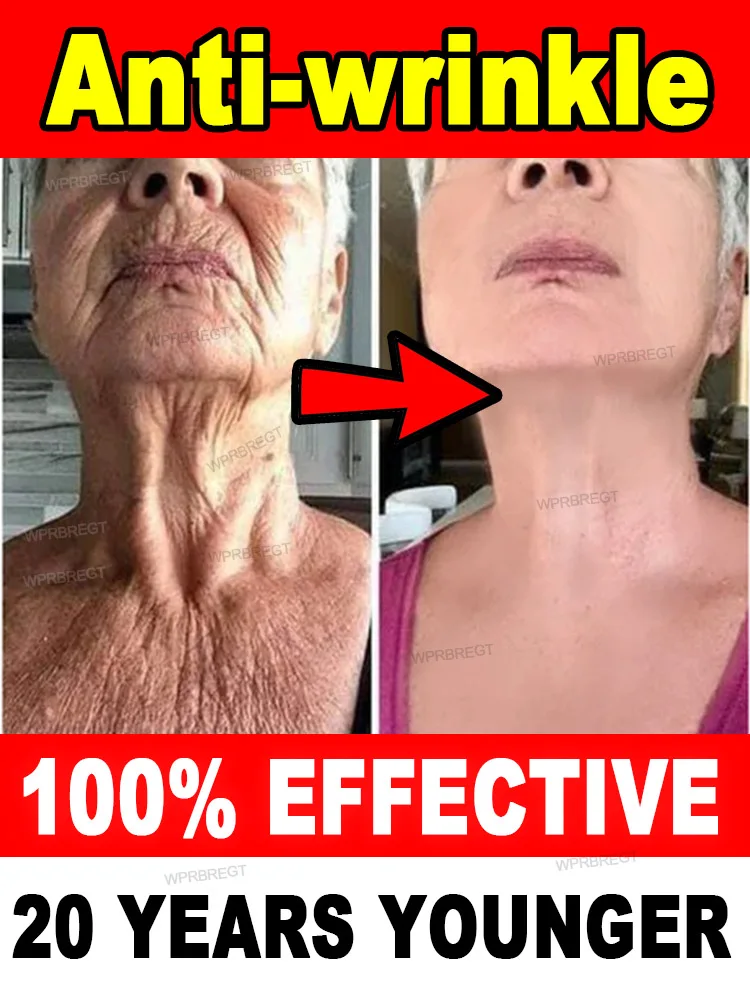 No wrinkles, 20 years younger