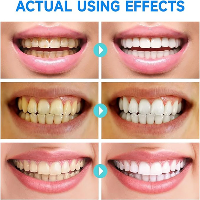 Pasta de dientes blanqueadora púrpura, 30ml, elimina las manchas, Reduce el cuidado del amarillento para las encías, aliento fresco, brillo de los dientes 2023