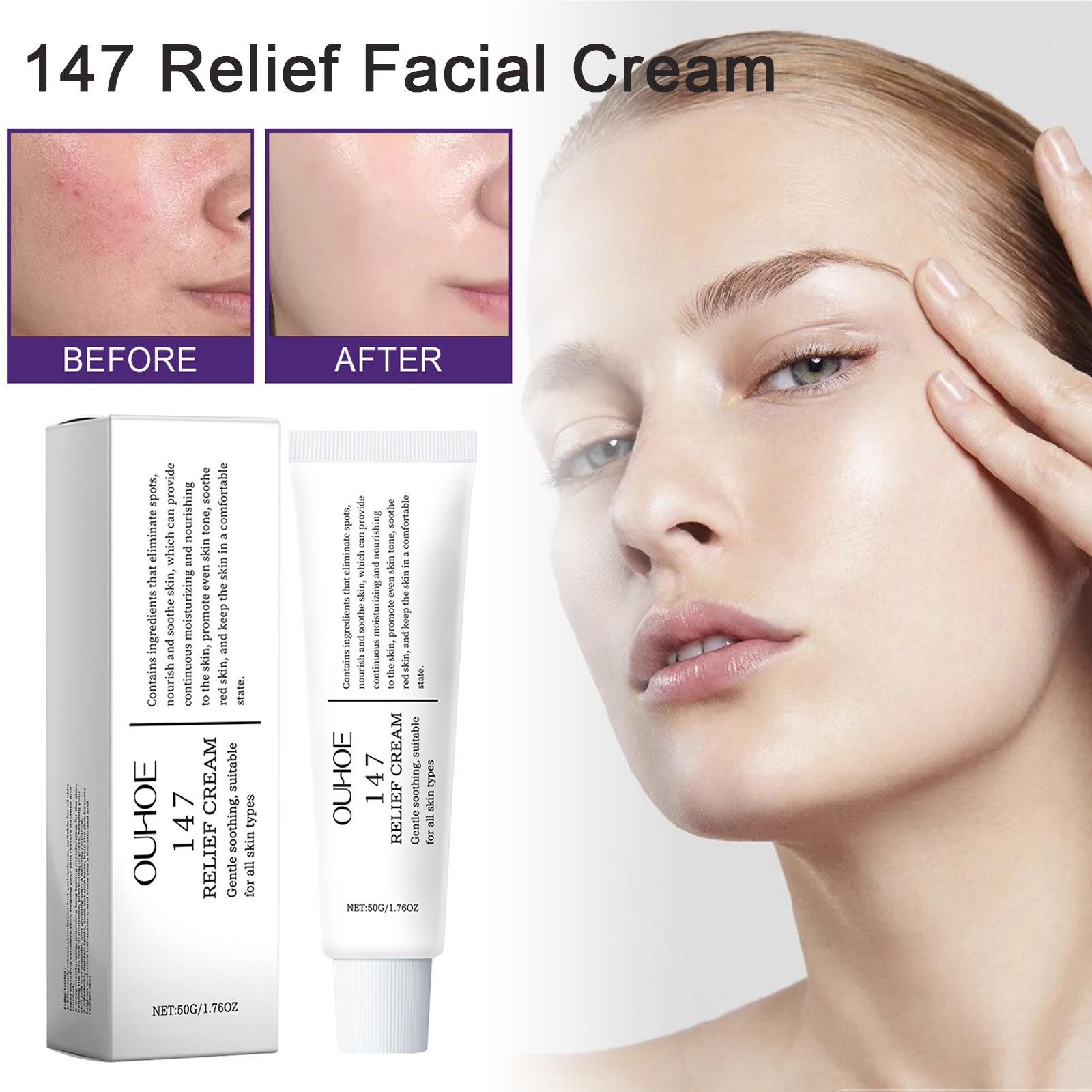 147 Relief Cream solution to skin problems Anti-sugar and antioxidant Address Blemishes Nourish Long lasting Moisturizer Korean