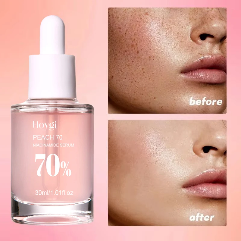 Pêssego 70% niacinamida soro 30ml hidratante evitar secura óleo essencial facial aumentando a elasticidade suave suavizar cuidados com a pele