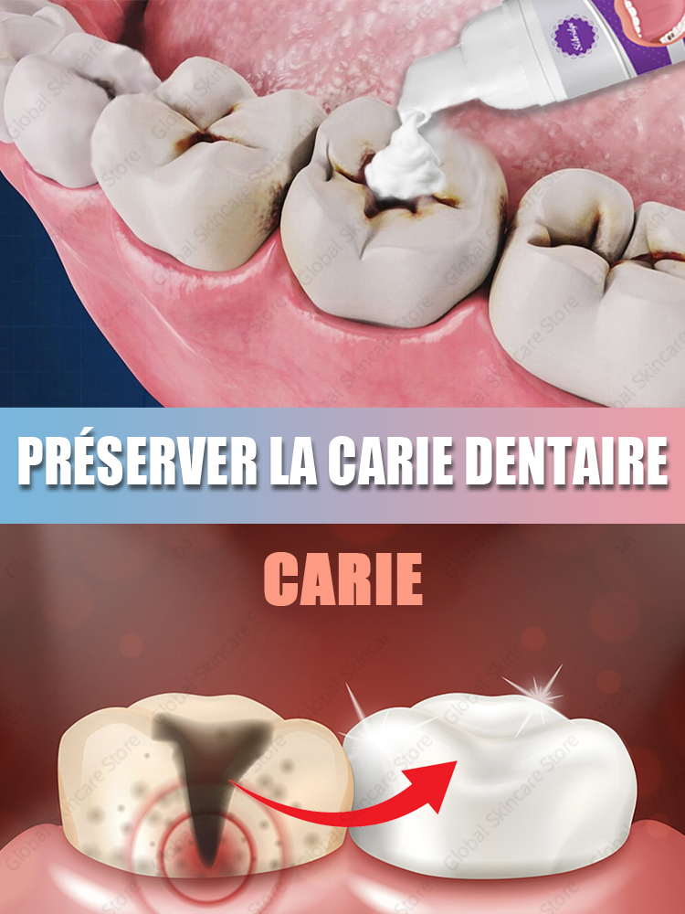 tooh Réparation de la carie