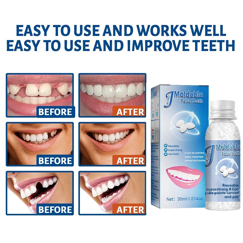 Solide Dental Kleber Für Zahnersatz Temporäre Falsche Zahn Reparatur Formbare Prothese Klebstoff DIY Schauspieler Make-Up Prothese Befestigungs Liefert