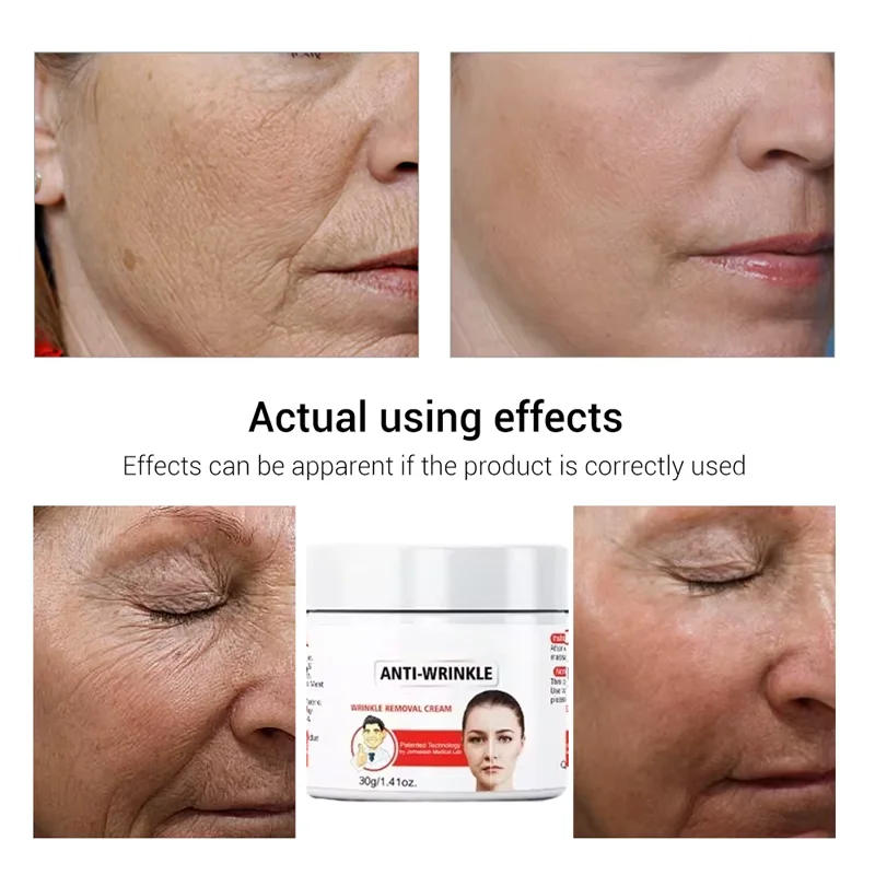 Efecto instantáneo antiarrugas para el envejecimiento, elimina las arrugas faciales, desvanece las líneas finas, reafirmante, cuidado de la piel Facial, cosmético coreano