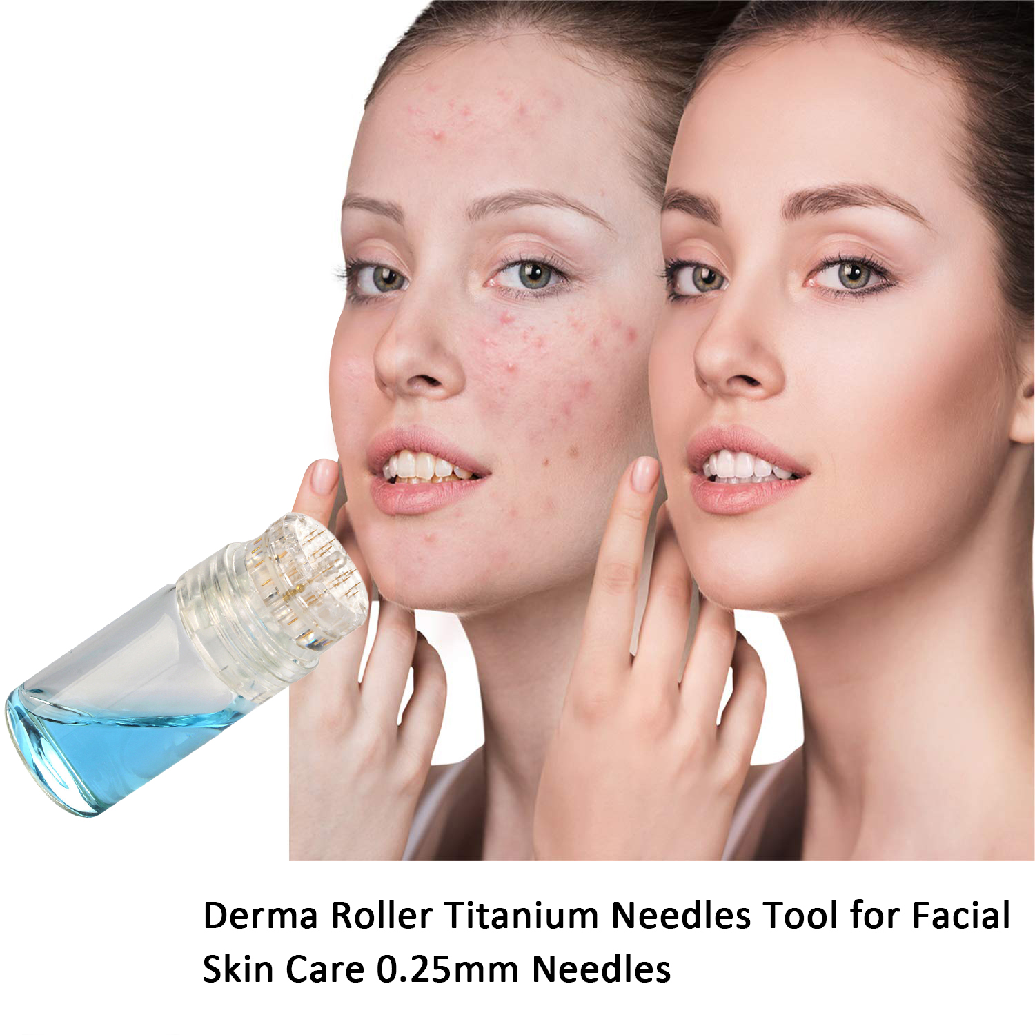Hydra Kim Titan Kim Dụng Cụ Và Serum Applicator-Mỹ Phẩm Derma Roller Dụng Cụ Cho Mặt, râu Tăng Trưởng-0.2Mm/0.25Mm/0.3Mm
