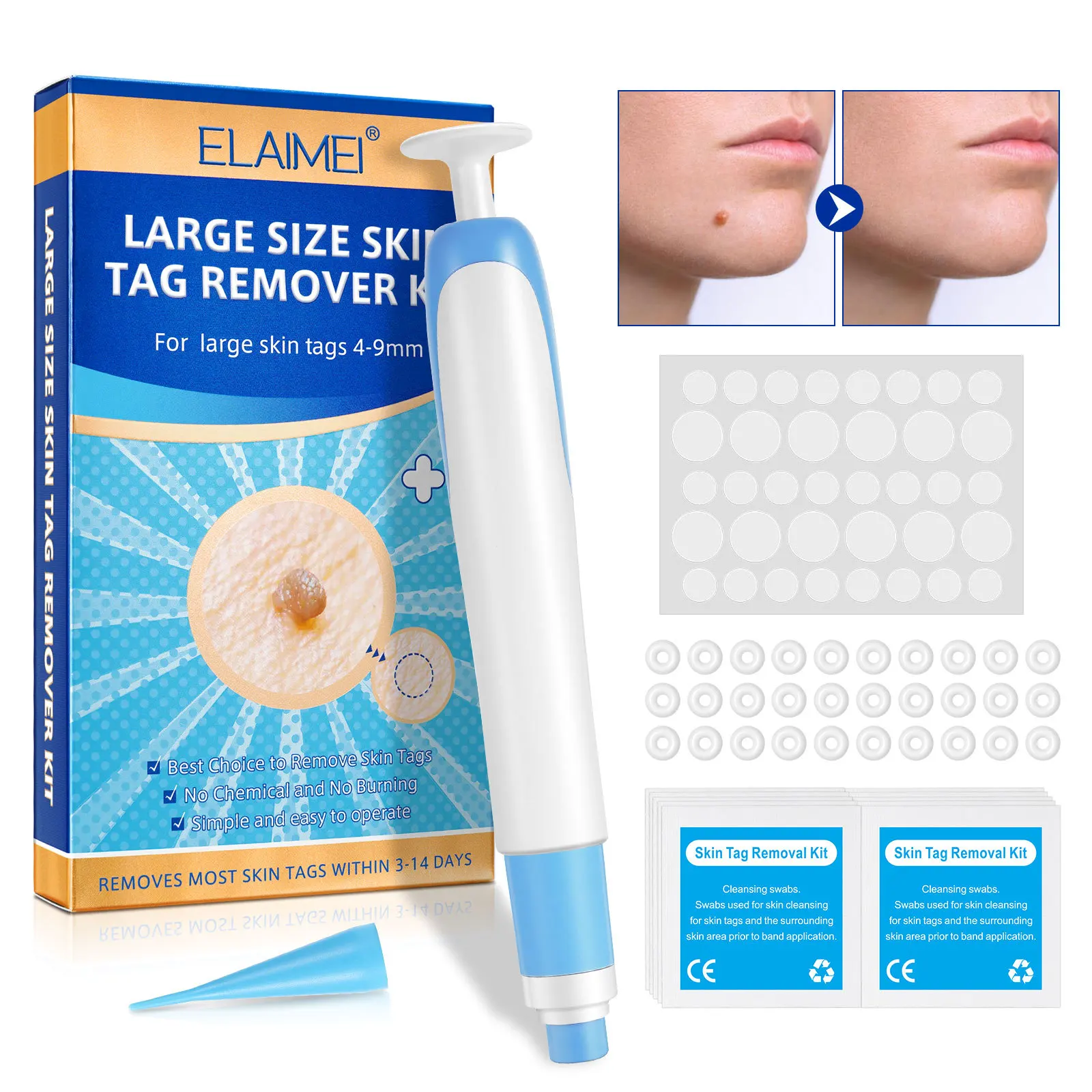 Kit automático de remoção de marcas de pele de tamanho grande para etiquetas de pele grandes 4-9mm com cotonetes de limpeza uso doméstico ferramenta de cuidados com a pele do rosto