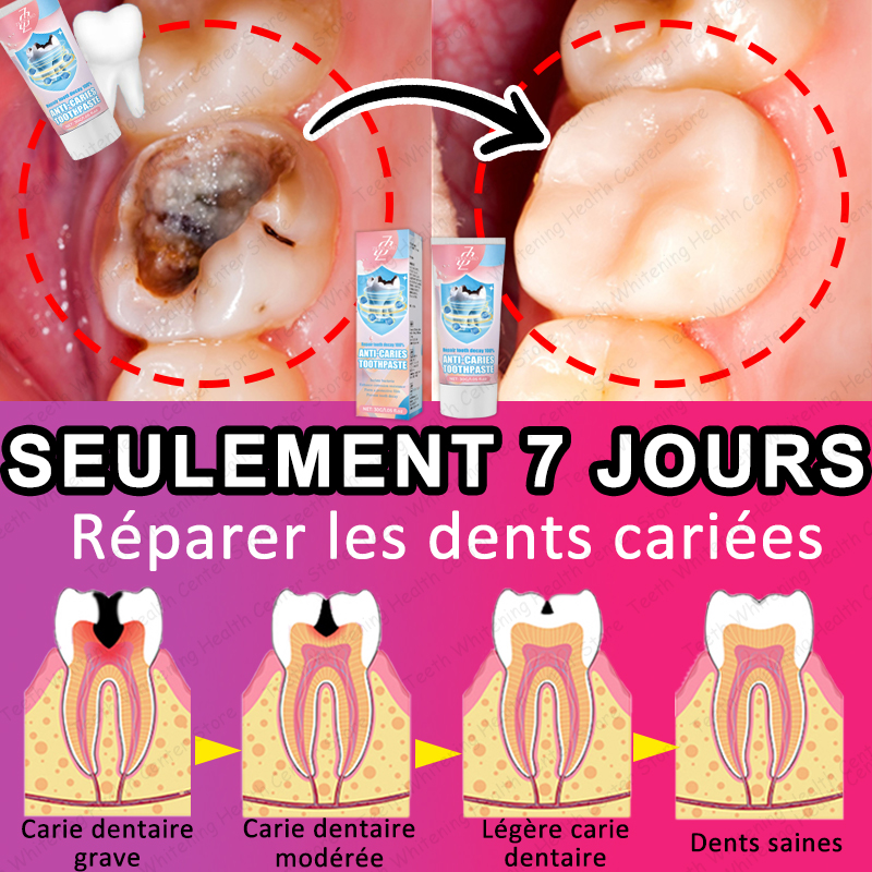 99% ᴅᴇ ᴘᴇʀsᴏɴɴᴇs ʀᴀᴄʜᴇᴛᴇʀ, ᴠᴇɴᴅʀᴇ ᴀ̀ ᴄʜᴀᴜᴅ, ʀᴇ́ᴘᴀʀᴇʀ ʟᴀ ᴄᴀʀɪᴇ ᴅᴇɴᴛᴀɪʀᴇ