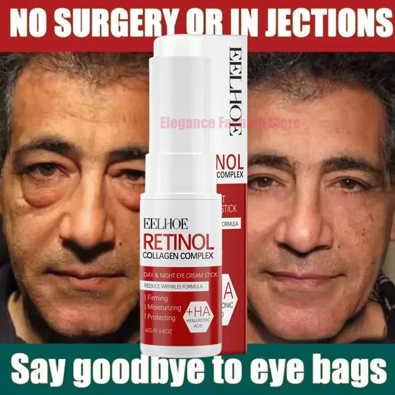 Bolsa de ojos instantánea, crema para eliminar los ojos, partículas antigras, ojeras, hinchazón, decoloración de líneas finas, brillo, belleza coreana, cuidado de los ojos
