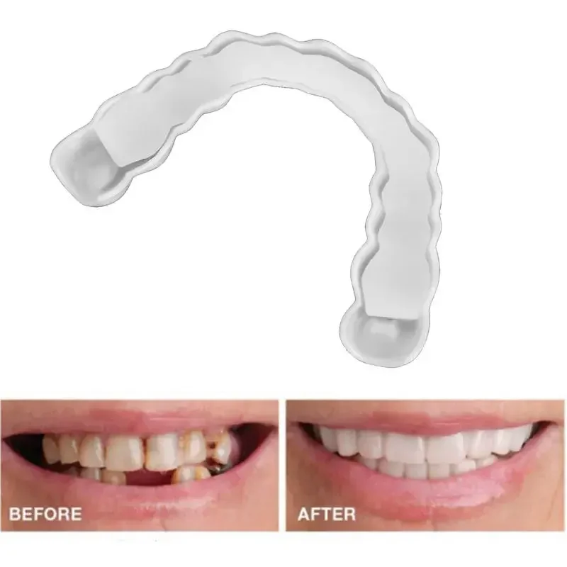 シリコン歯のホワイトニング,偽の歯のカバー,スナップオン,smile veneers,上の美容ツール,化粧歯,送料無料