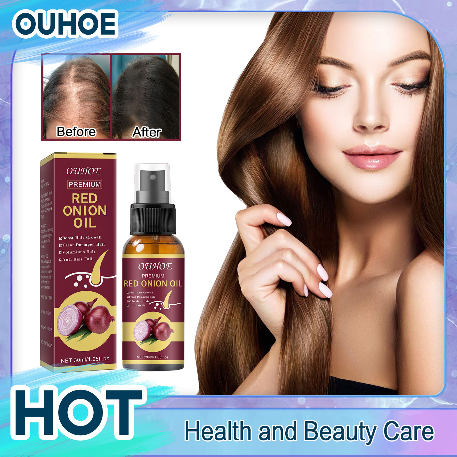 Suero en aerosol para el crecimiento del cabello, previene la caída del cabello, tratamiento del cuero cabelludo, mejora la fortalecimiento de la Alopecia, aceite esencial de cebolla roja, Frizz seco