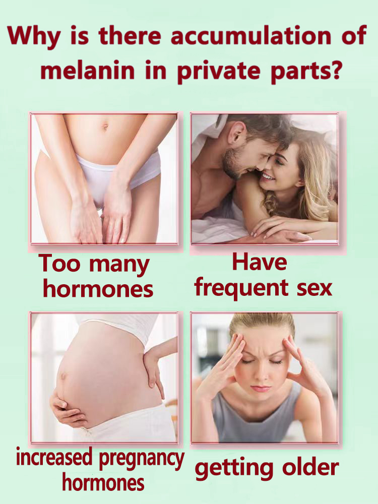 Скажи прощай в меланин