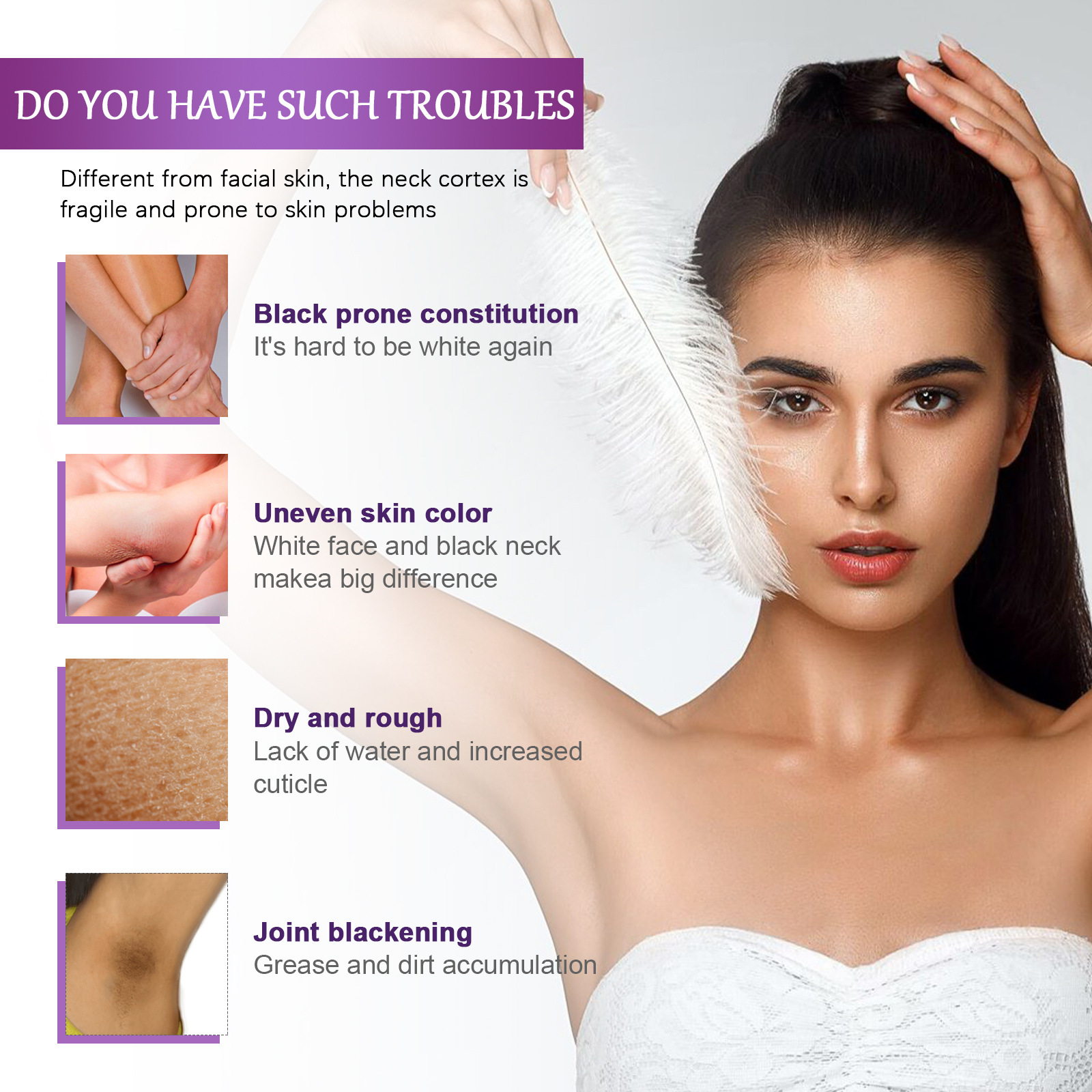 Körperaufhellungslotion, Entferner dunkler Flecken für Achseln, Knie, Ellenbogen, Melanin, Aufhellung, Aufhellung der Haut, Feuchtigkeitscreme, 60 g