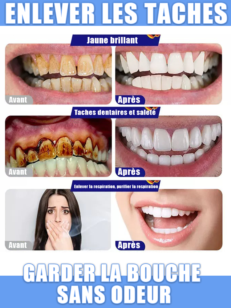 Blanchiment des dents, restauration rapide et naturelle des gencives, avis utilisateurs extrêmement positifs