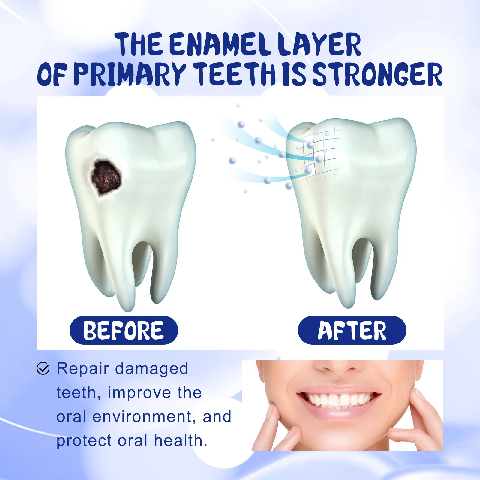 Anti Decay ยาสีฟันทันตกรรมฟันผุครีมป้องกันฟันผุป้องกันฟันลบแผ่นปวดฟันบรรเทาโรคปริทันต์อักเสบ