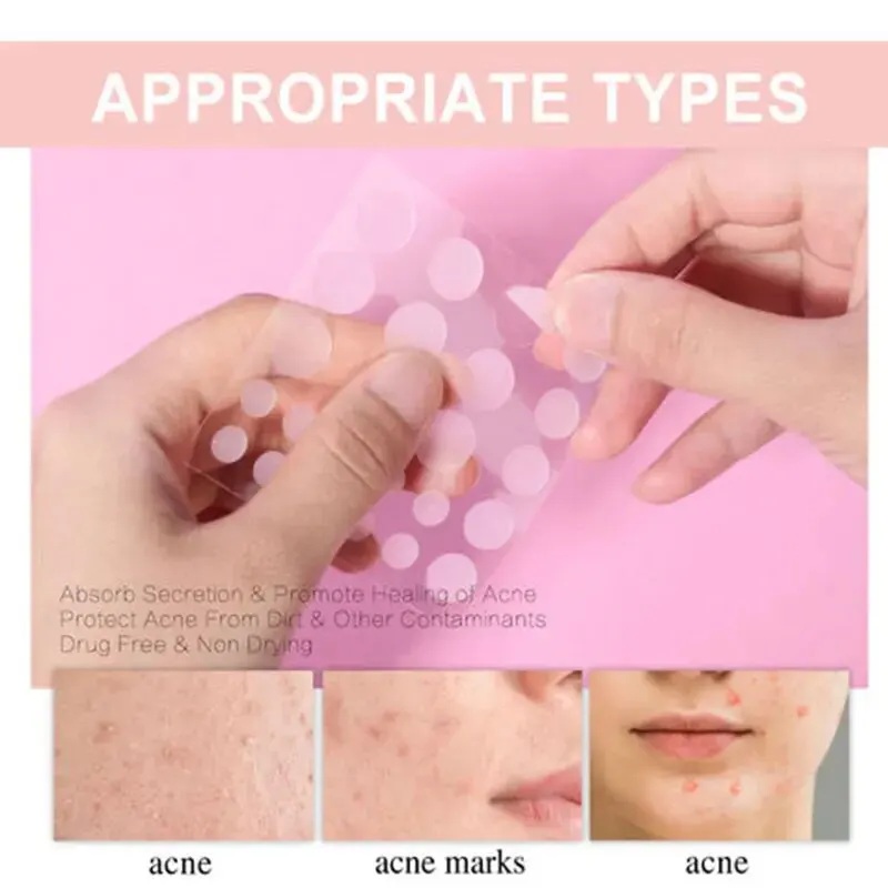 【Hot sales】72pcs Patches The Look Of Comedo And Invisible Concealer Breathable Covering Patch，Facial oil blotting paper
