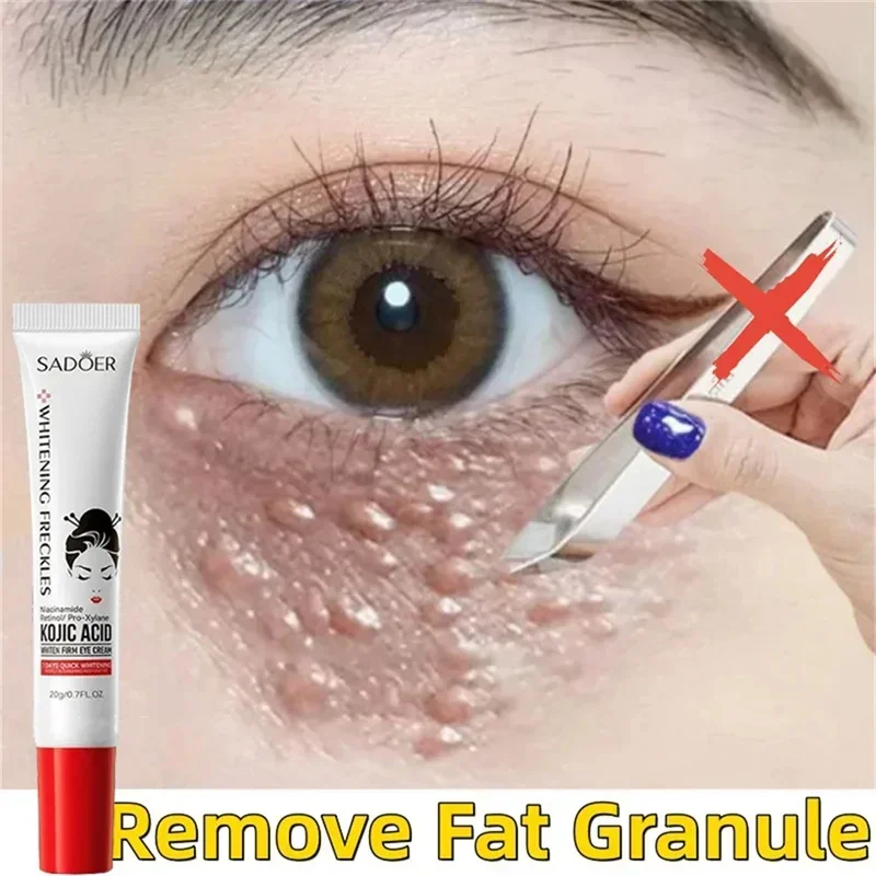 Crema para ojos eliminador de gránulos de grasa, crema firme antihinchazón, antiinflamatorio, Reduce las ojeras, desvanece las líneas finas, barrera reparadora Sk