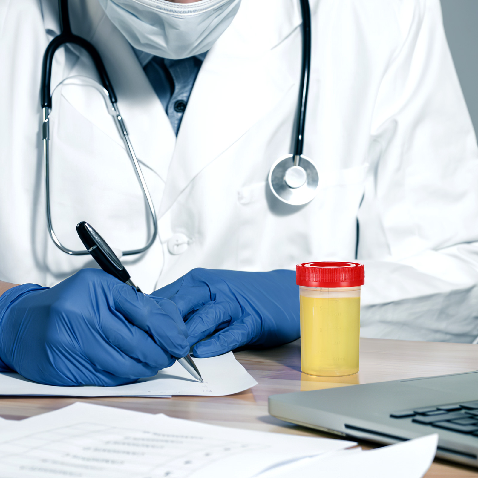 10 ชิ้นปัสสาวะทางการแพทย์ถ้วยตัวอย่างภาชนะสําหรับฝาครอบตัวอย่างขวดทดสอบพลาสติกถ้วยของเหลวคอลเลกชัน