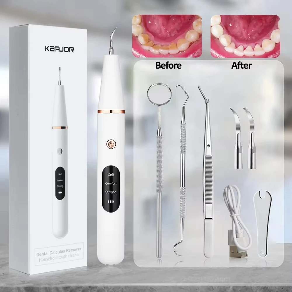 อัลตราโซนิกทันตกรรมแคลคูลัสRemoverฟันแผ่นScaler Tartar Eliminatorคราบทําความสะอาดไฟฟ้าทันตกรรมฟันหินRemover