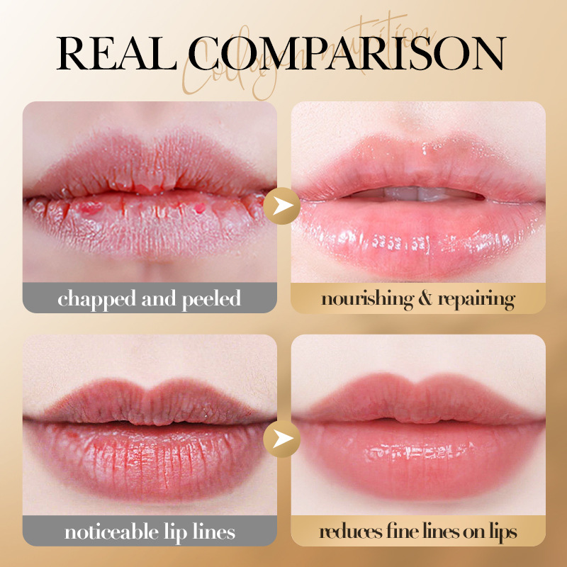 SADOER Collagen Lip Balm - Moisturizing Anti-Cracking, Brightening & Repairing Lip Care with Nourishing Hydration  ﻿