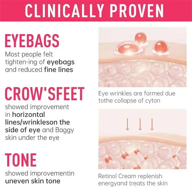 Retinol creme para os olhos remoção instantânea de saco de olho anti-rugas firmando a pele desbotar linhas finas anti círculo escuro inchaço iluminar cuidados com os olhos