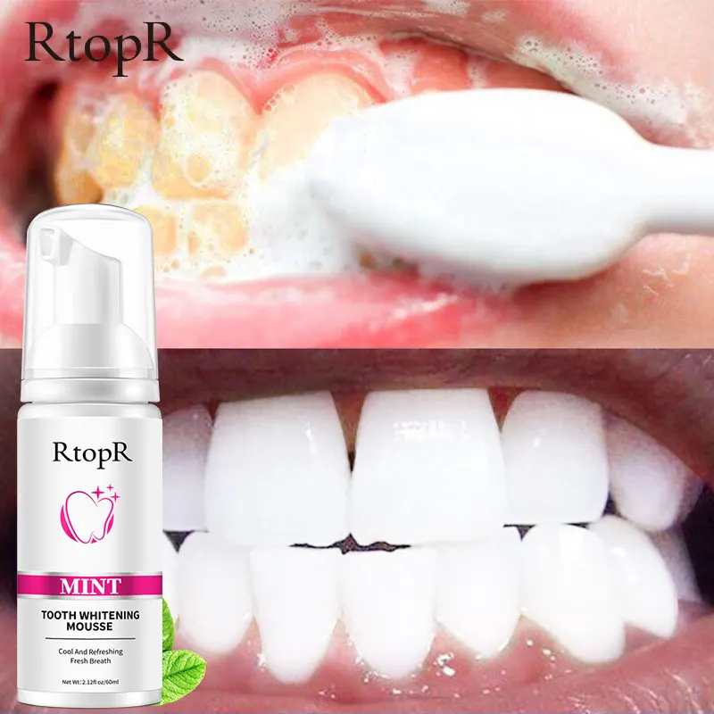 RtopR Răng Tẩy Các Vết Bẩn Loại Bỏ Hơi Thở Tươi Mát Làm Trắng Răng Mousse Vệ Sinh Răng Miệng Mousse Foam Di Động Du Lịch Kem Đánh Răng