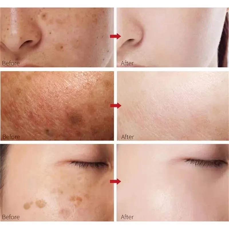 Pêssego 70% niacinamida soro 30ml hidratante evitar secura óleo essencial facial aumentando a elasticidade suave suavizar cuidados com a pele