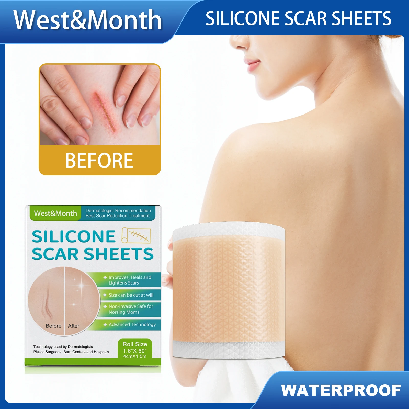West เดือนซิลิโคนแผ่นแผลเป็นไม่เจ็บปวดที่มีประสิทธิภาพกันน้ํา Sweatproof Breathable สติกเกอร์ความงาม Skin Care แต่งหน้าความงาม