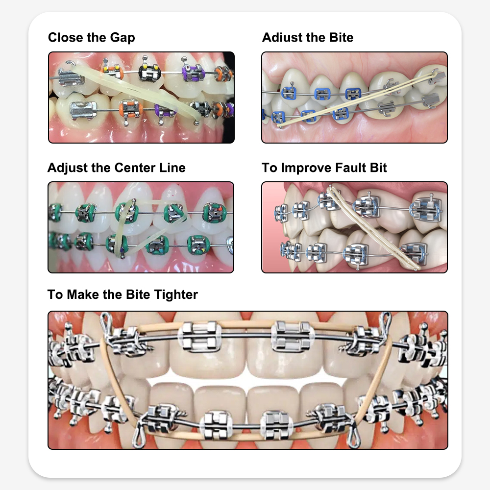 CYZ115 XYSZ 5000 ピース/箱 O リング/インターマウスゴム歯科矯正動物園パックゴムバンドラテックス結紮ネクタイ