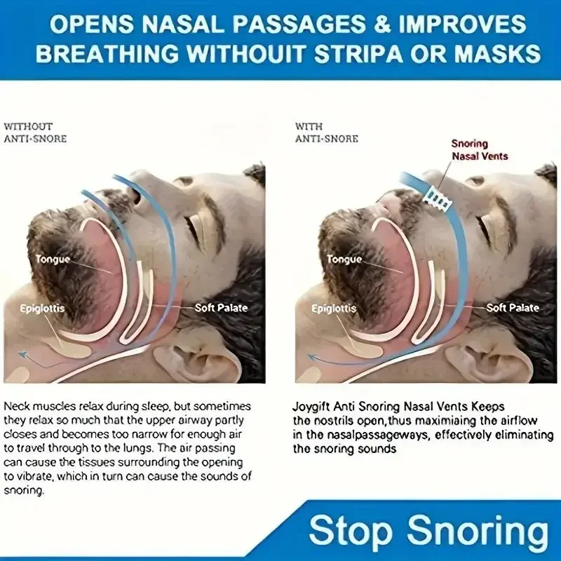 1pc 抗いびき鼻拡張器簡単な呼吸コーン混雑補助睡眠補助装置いびきを止める鼻拡張器