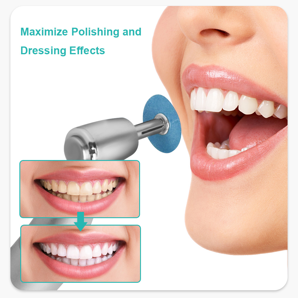 40pcs/Box Dental Composite Polishing Disc Gross Reduction Contouring Mandrel Stripes for Ceramics and Glass Ionomer Restorations