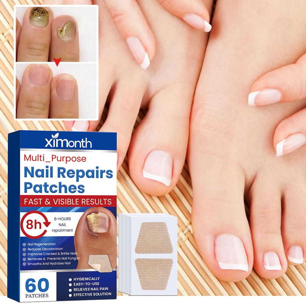Parches de piezas para uñas de los pies, accesorio de reparación de uñas de los pies, no irritante y transpirable, 60 unidades