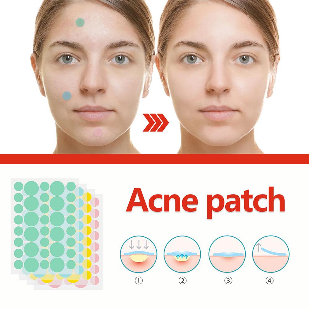 144pcs Invisible Removal Pimple Anti-Acne Hydrocolloid Patches Spots Marks Concealer Repair Sticker Waterproof