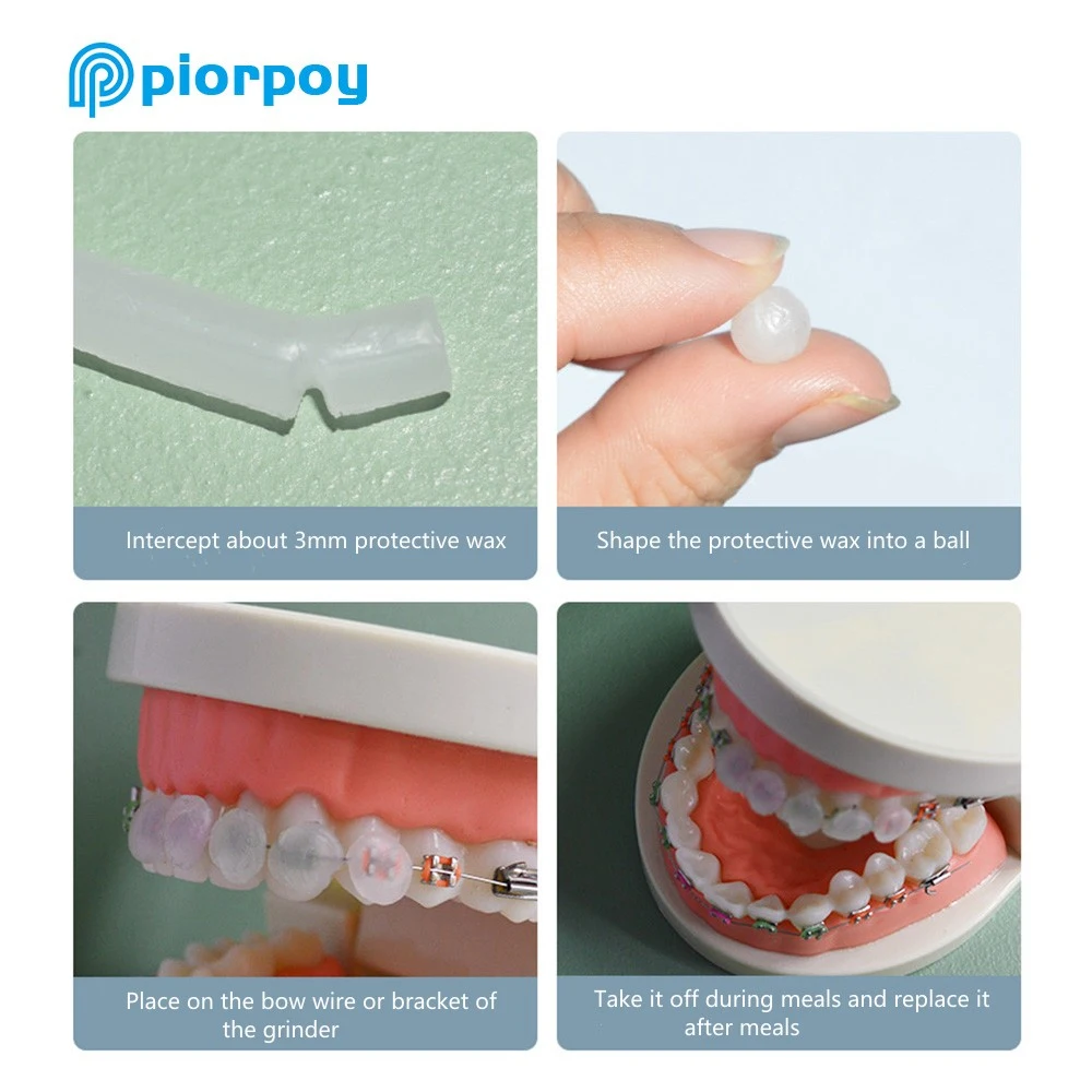 Piorpoy 10กล่องขี้ผึ้งสำหรับจัดฟันสำหรับจัดฟันสวมใส่ฟอกสีฟัน10ชนิดแท่งขี้ผึ้งกายอุปกรณ์ทันตกรรม