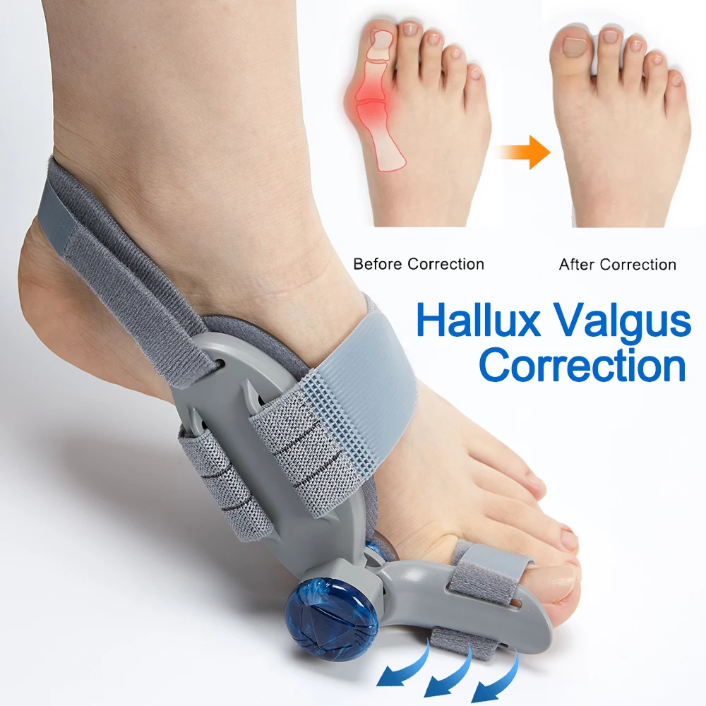 Férula para juanete, alisador de dedo gordo, corrección de Hallux Valgus, ortopédicos, hueso del pie, ajustador del pulgar, Corrector de juanetes