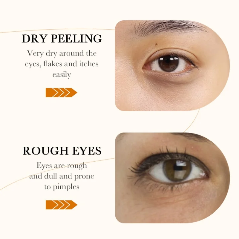 60pcs BIOAQUA Máscara de olho de polpa crua de arroz Anti olheiras Sacos de olhos Removedor de hidratação reafirmante