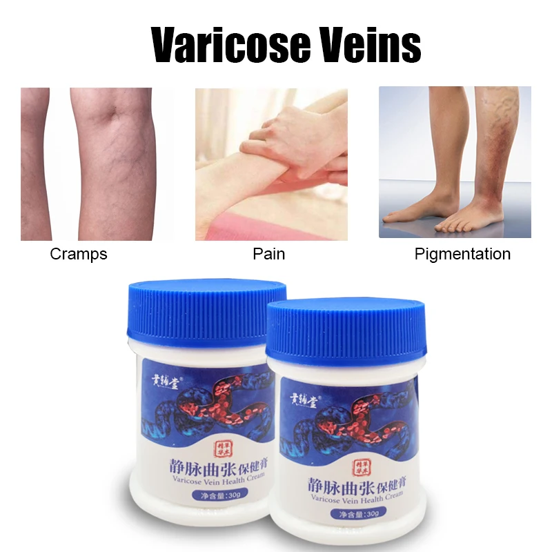 Giãn Tĩnh Mạch Kem Điều Trị Viêm Mạch Phlebitis Nhện Giảm Đau Tinh Dầu Varicosity Angiitis Loại Bỏ 100% Nguyên Bản Thảo Dược