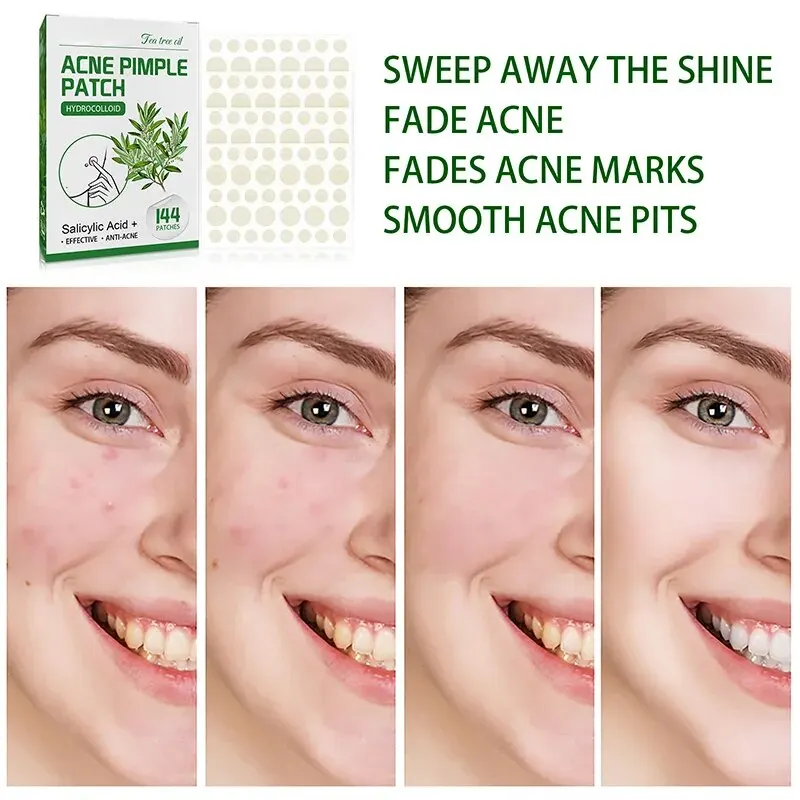 แพทช์สิวที่มองไม่เห็นแต่งหน้าที่มองไม่เห็น Clarifying แพทช์สิววงกลมปิดสิวจางเครื่องหมายสิวกันน้ําให้ความชุ่มชื้น