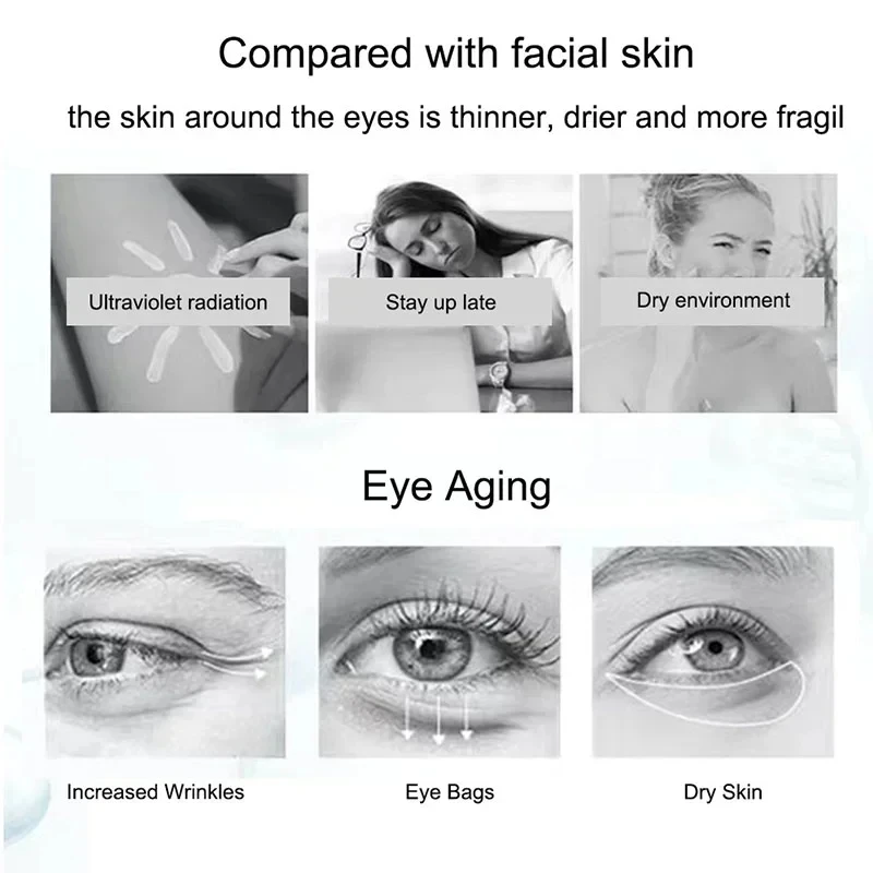 Creme para os olhos com nicotinamida, creme para olheiras, remove bolsas para os olhos, ácido hialurônico, soro hidratante contra inchaço, gel para cuidados com os olhos
