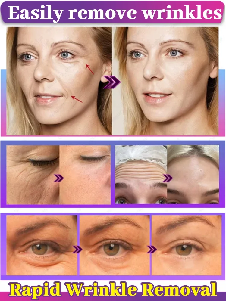 20-летний младший, 100% морщины исчезают