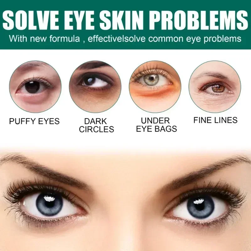 Crema para los ojos con arrugas de 7 días, antiojeras, hinchazón, líneas finas, blanqueamiento, cuidado coreano de la piel, novedad de 2023