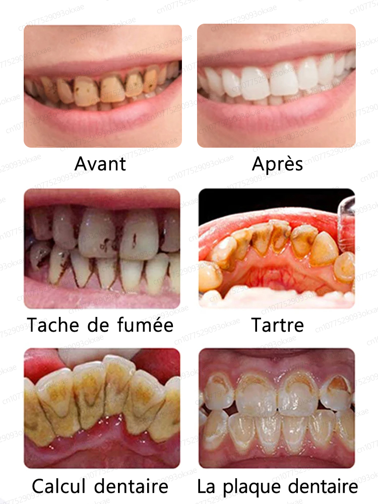 Blanchiment des dents, restauration rapide et naturelle des gencives, avis utilisateurs extrêmement positifs