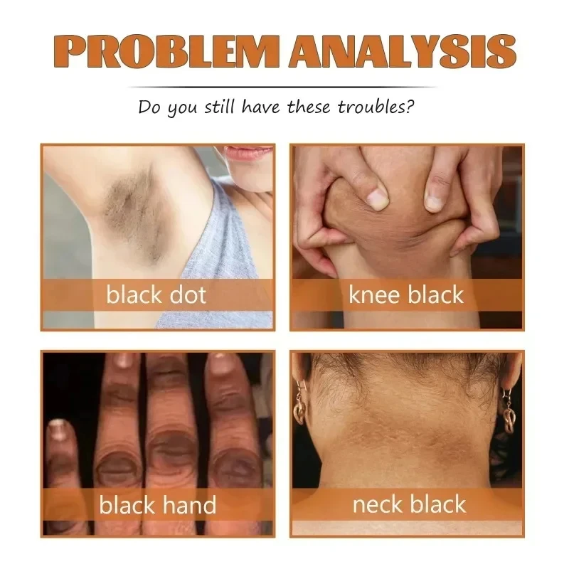 Witter Serum Geel Bleken Peeling Exfoliërende Dode Huidverzorgingsolie Donkere Huid Verwijderen Arm Kniebenen Melanine Body Fleuren Scrub