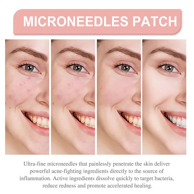 Pickel Patch unsichtbare Schönheit Concealer atmungsaktive Gesichts pflege sanfte nicht reizende reinigende Poren tragbar transparent