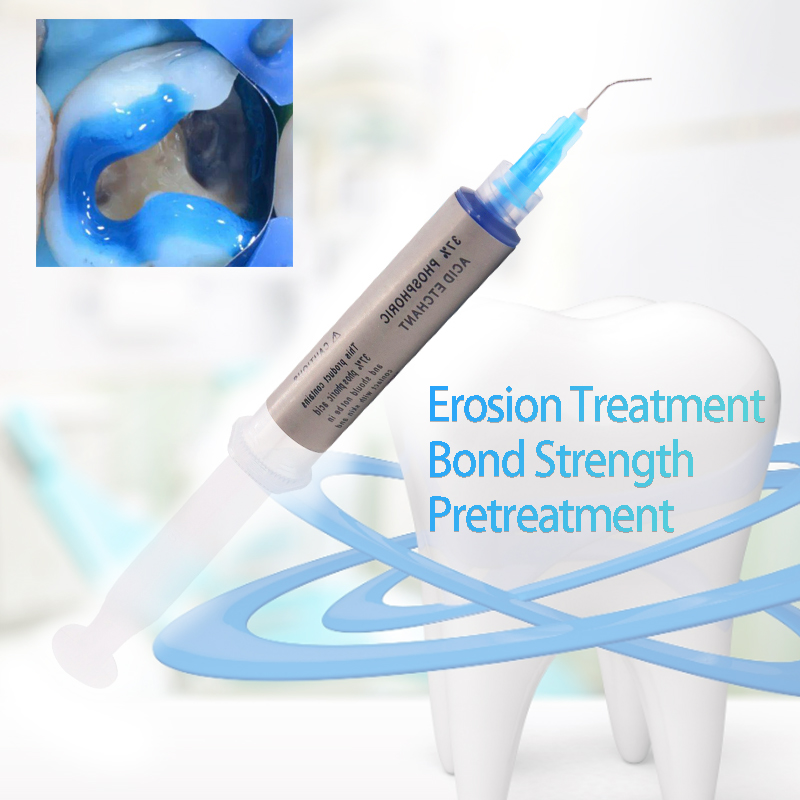Dental Bonding AgentDentin กาวฟันกรดแกะสลักเจลแกะสลัก Light-Cure คริสตัลเครื่องประดับเครื่องประดับอัญมณีเพชรกาว