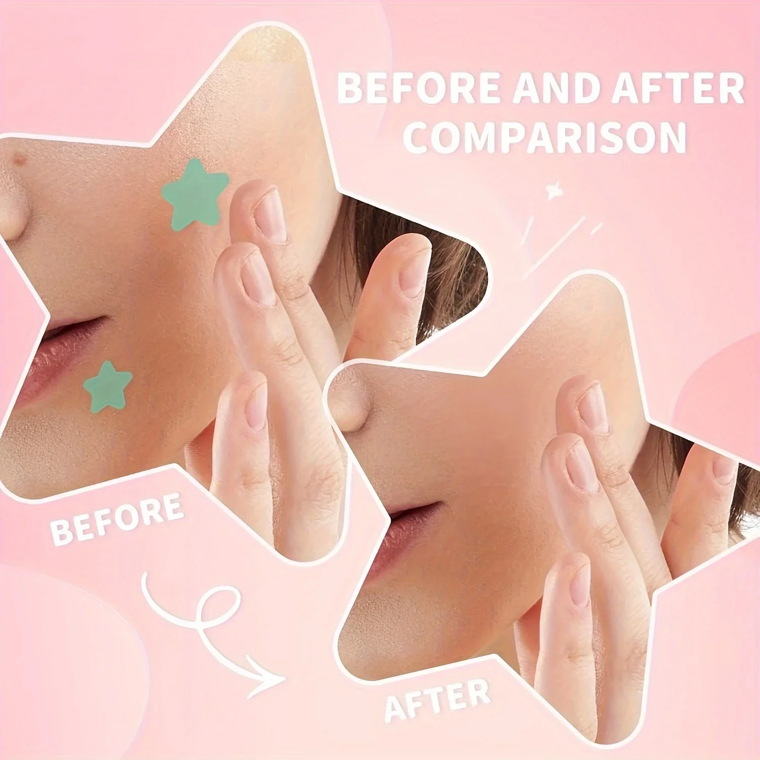 200 pz Acne Brufolo Patch Adesivi Trattamento Impermeabile Macchia di Rimozione Macchia Maschera Per Il Viso Strumento di Cura Della Pelle per Brufoli Nascosti