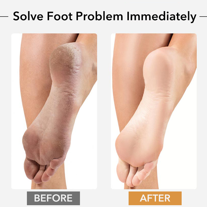 1PCS Professional Pedicure Rasp Tool for Dead Skin Crack Heels Beech Wood Foot File Rasp Callus Remover Foot Scrubber