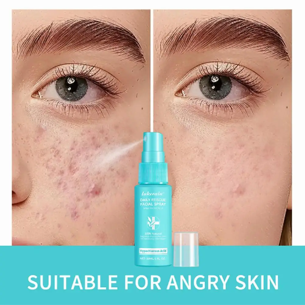 Semprotan Wajah Penyelamatan 30Ml untuk Kulit Sensitif Semprotan Asam Hipoklorit Membantu Mengurangi Kemerahan Semprotan Penyeimbang PH yang Menenangkan