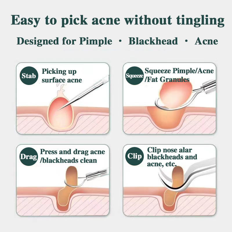 Acne Needle Blackhead Cell Clip Suit Double-Headed Acne Needle Acne Acne Removal Needle Tweezers Precision Acne Clip Acne Tool