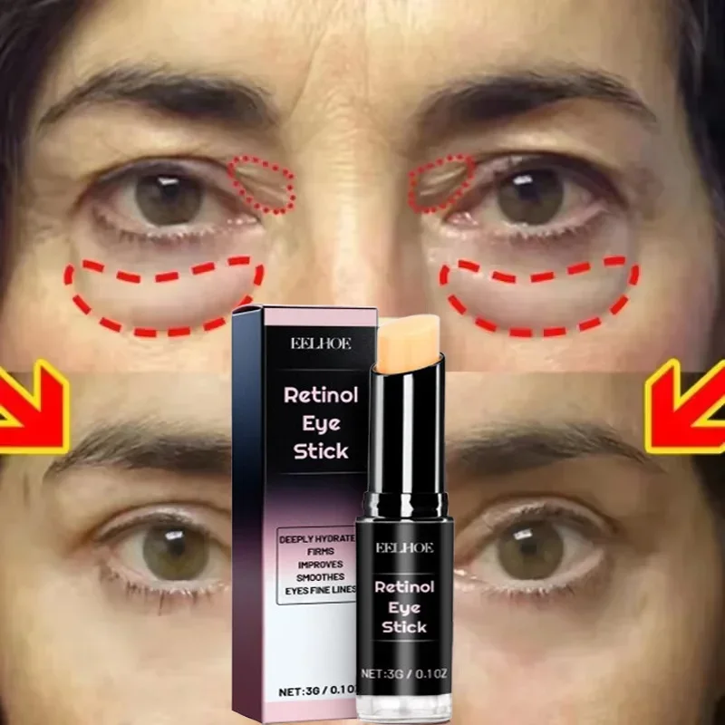 Removal Instant Eye Bag Cream Collagen Anti-Wrinkle Fade Fine Lines Firming Skin Anti Dark Circle Puffiness Brighten Eye Care