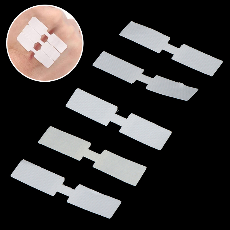 10Pcs สายรัดกันน้ำผีเสื้อกาวปิดแผล Band Aid ฉุกเฉินชุดกาวผ้าพันแผลผ้าพันแผลกาว First Aid