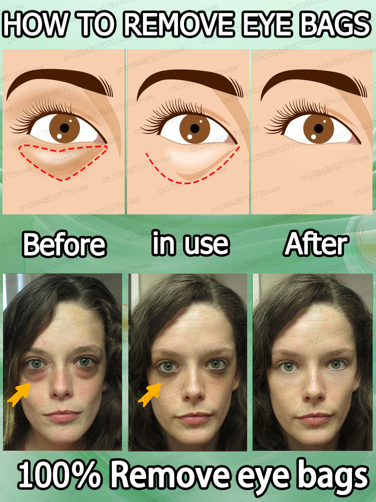 оставайся подогревом эссенции для глаз, сохраните свои глаза навсегда молодые